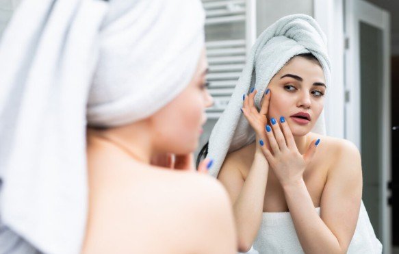 Managing Exfoliation